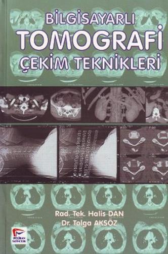 Bilgisayarli Tomografi Çekim Teknikleri