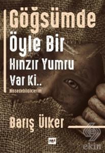 Göğsümde Öyle Bir Hınzır Yumru Var Ki