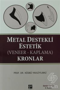 Metal Destekli Estetik (Veneer-Kaplama)Kronlar