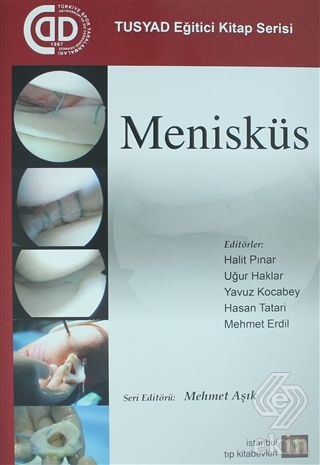 Menisküs