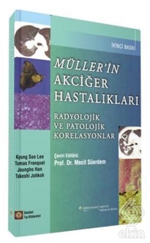 Müller\'in Akciğer Hastalıkları