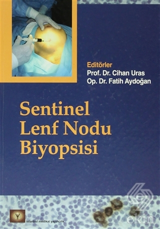 Sentinel Lenf Nodu Biyopsisi