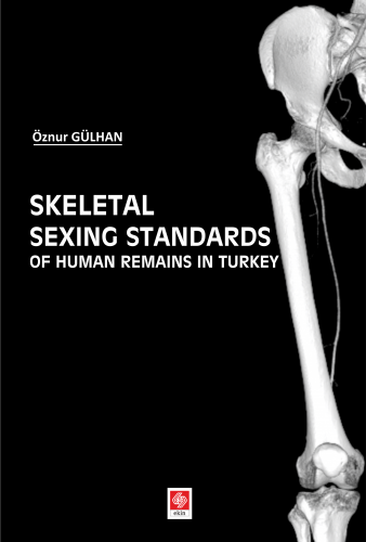 Skeletal Sexing Stadards Of Human Remains in Turke