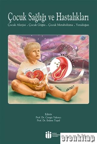 Çocuk Sağlığı ve Hastalıkları : Çocuk Alerjisi, Çocuk Gögüs, Çocuk Metabolizma,Yenidoğan