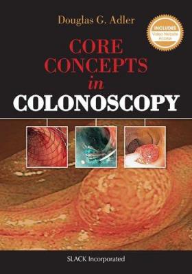 Core Concepts in Colonoscopy Douglas Adler