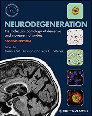 Neurodegeneration Dennis Dickson