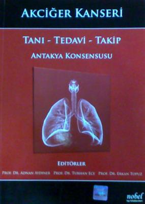 Nobel Tıp Akciğer Kanseri Tanı Tedavi Takip