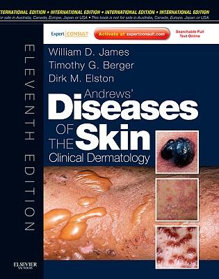 Andrews' Diseases of the Skin William James