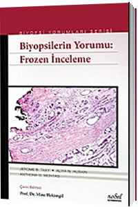 Nobel Tıp Biyopsilerin Yorumu, Frozen İnceleme Biyopsi Yorumları Seris