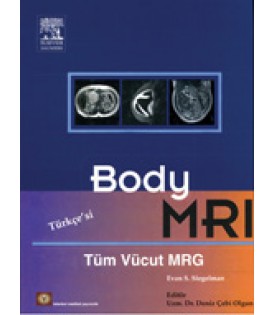 Body MRI ( Türkçesi ) Deniz Çebi Olgun