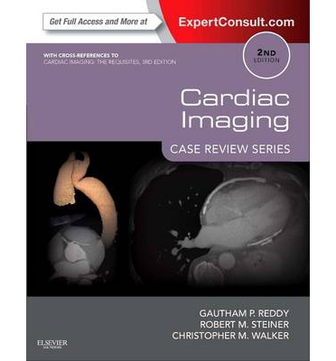 Cardiac Imaging: Case Review Series Reddy