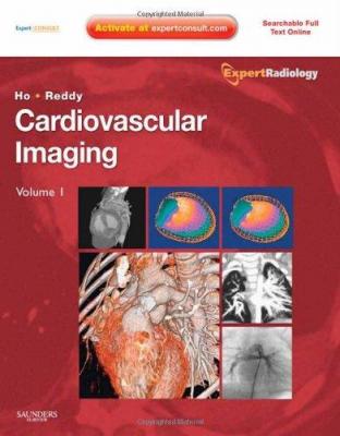 Cardiovascular Imaging Gautham P. Reddy