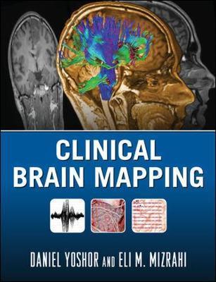 Clinical Brain Mapping Daniel Yoshor
