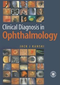 Clinical Diagnosis in Ophthalmology TÜRKÇE - Kanski - Berati Hasanreis