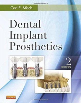 Dental Implant Prosthetics Misch