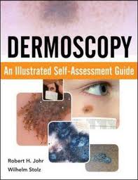 Dermoscopy: An Illustrated Self-Assessment Guide - Robert Johr, Wilhel