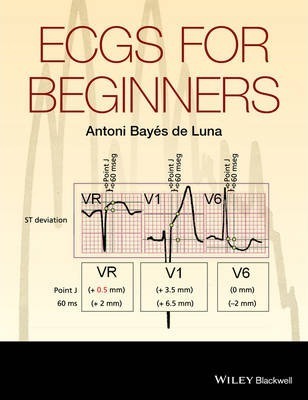 ECGs for Beginners Antoni Bayes de Luna
