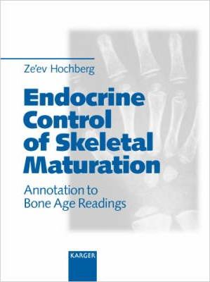 Endocrine Control of Skeletal Maturation: Annotation to Bone Age Readi