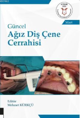 Güncel Ağız Diş Çene Cerrahisi Mehmet Kürkçü