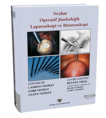 Güneş Tıp Nezhat Operatif Jinekolojik Laparoskopi ve Histeroskopi
