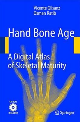 Hand Bone Age, A Digital Atlas of Skeletal Maturity Vicente Gilsanz