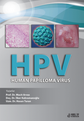 HPV - Human Papilloma Virus Macit Arvas