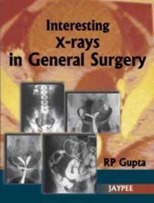 Interesting X-Rays in General Surgery RP Gupta