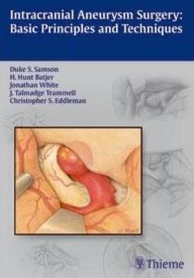 Intracranial Aneurysm Surgery: Basic Principles and Techniques Duke Sa