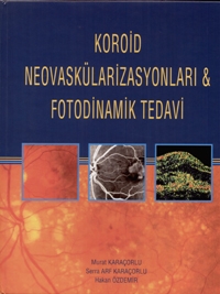 Koroid Neovaskülarizasyonları ve Fotodinamik Tedavi – Murat Karaçorlu