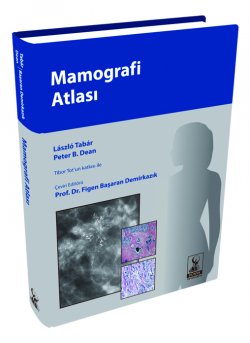 Mamografi Atlası Figen Başaran Demirkazık