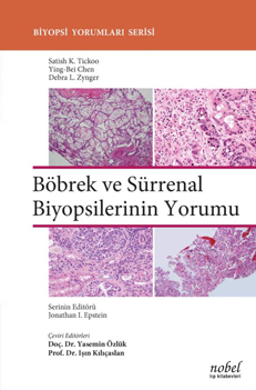 Nobel Tıp Böbrek ve Sürrenal Biyopsilerinin Yorumu - Biyopsi Yorumları