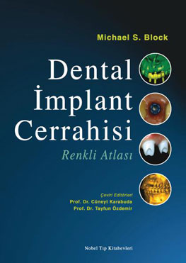 Nobel Tıp Dental İmplant Cerrahisi Renkli Atlası - Cüneyt Karabuda,Tay