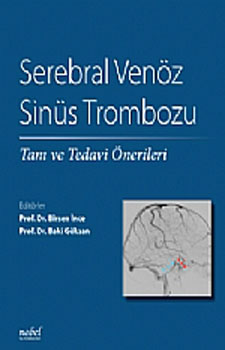 Nobel Tıp Serebral Venöz Sinüs Trombozu: Tanı ve Tedavi Önerileri