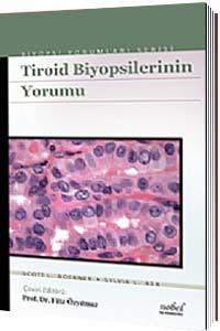 Nobel Tıp Tiroid Biyopsilerinin Yorumu - Biyopsi Yorumları Serisi