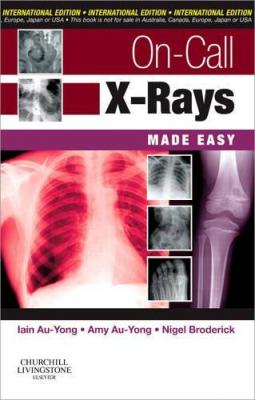 On-Call X-Rays Made Easy Au-Yong
