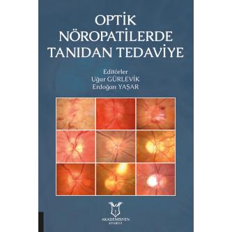 Optik Nöropatilerde Tanıdan Tedaviye Uğur GÜRLEVİK