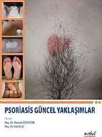 Psoriasis Güncel Yaklaşımlar – Mustafa Özdemir, Erol Koç Mustafa Özdem