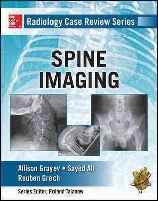 Radiology Case Review Series: Spine Imaging Allison Michele Grayev