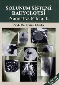 Solunum Sistemi Radyolojisi Normal ve Patolojik