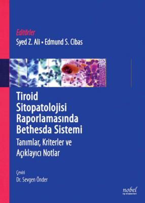 Tiroid Sitopatolojisi Raporlamasında Bethesda Sistemi Tanımlar, Kriter