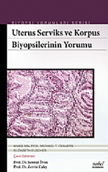 Nobel Tıp Uterus Serviks ve Korpus Biyopsilerinin Yorumu Biyopsi Yorum