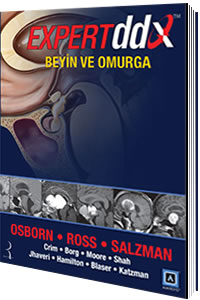Expert DDX: Beyin ve Omurga - kitap Anne G. Osborn
