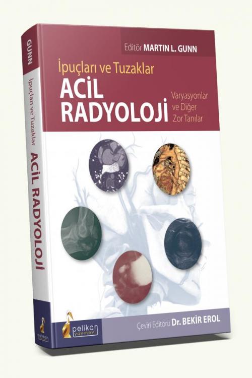İpuçları ve Tuzaklar Acil Radyoloji - kitap Bekir Erol