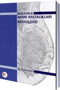 Olgularla Meme Hastalıkları Radyolojisi, Kemal Arda - kitap Doç. Dr. K