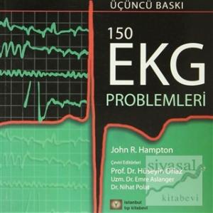 150 EKG Problemleri