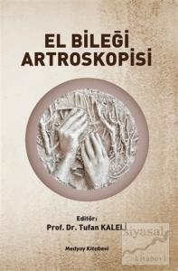 El Bileği Artroskopisi El Bileği Artroskopisi