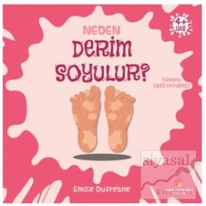 Neden Derim Soyulur?