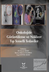 Onkolojide Görüntüleme ve Nükleer Tıp Temelli Tedaviler