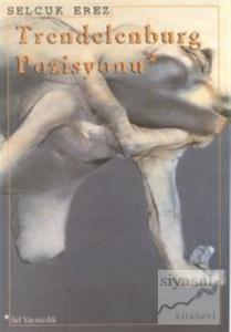 Trendelenburg Pozisyonu