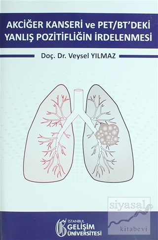 Akciğer Kanseri ve PET/BT'deki Yanlış Pozitifliğin İrdelenmesi Veysel 